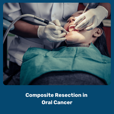 Oral Surgery