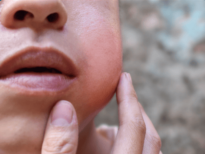 Oral Surgery